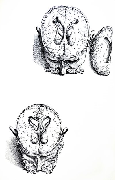 Las Láminas del Séptimo Libro de De Humani Corporis Fabrica de Andreas Vesalius