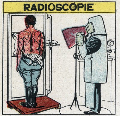 Rayos X: radioscopia de un cuerpo humano. El radiólogo se protege de los rayos X usando una tela de goma con una disolución de plomo, su cabeza está cubierta con una gorra y sus manos con guantes del mismo material, sus ojos están protegidos de Anonymous Anonymous