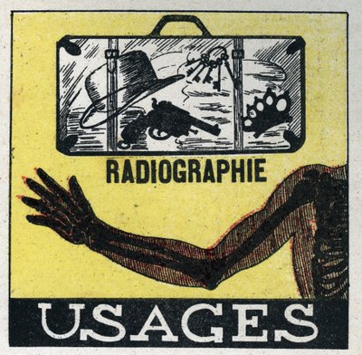 Rayos X: uso de rayos X para ver a través de objetos y cuerpos. Ilustración anónima de 1925. Colección privada. de Anonymous Anonymous