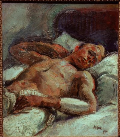 Herido de Anton Kolig