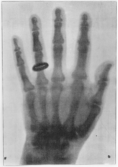 Radiografía de la mano izquierda de Anna Bertha Ludwig, esposa de Röntgen de Carl August Voller