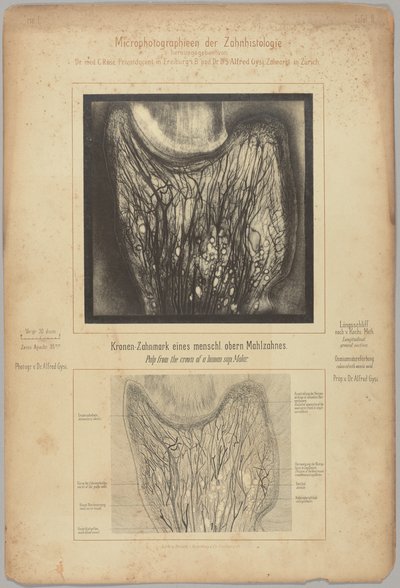 Pulpa de la corona de un molar superior humano de Dr. Alfred Gysi