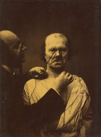 Agresión, maldad, 1854-1856, impreso 1862 de Duchenne de Boulogne
