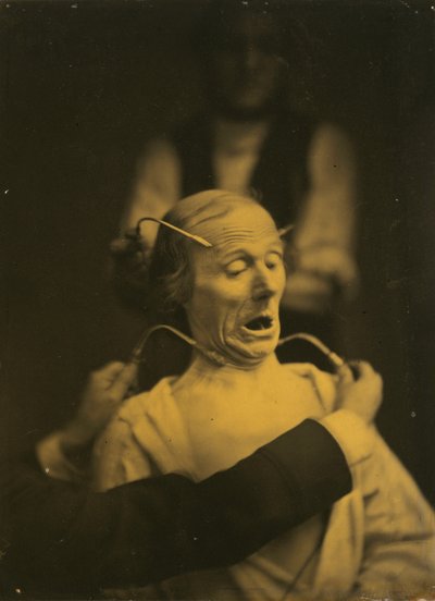 Expresión de Terror, 1854-1856, impreso en 1862 de Duchenne de Boulogne