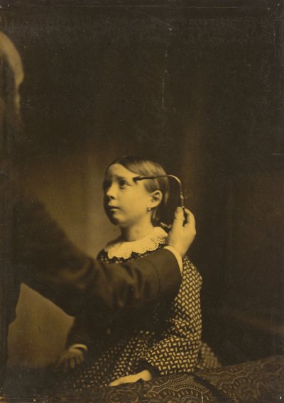 Recuerdos dolorosos de Duchenne de Boulogne