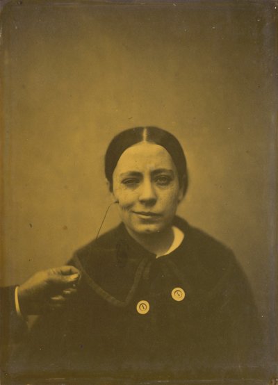 Ligera bajada del ángulo de la boca debido a la depresión izquierda, risa falsa derecha, 1854-185 de Duchenne de Boulogne