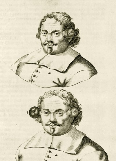 Un ejemplo de ventosas, de Exercitationes Practicae circa Medendi Methodum por Frederik Dekkers, 1694 de Dutch School