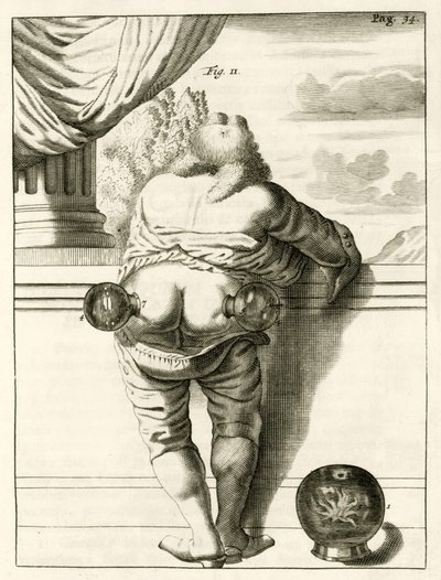 Un ejemplo de ventosas, de Exercitationes Practicae circa Medendi Methodum por Frederik Dekkers, 1694 de Dutch School