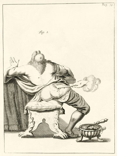 Lanceando un forúnculo en el trasero, de Exercitationes Practicae circa Medendi Methodum por Frederik Dekkers, 1694 de Dutch School