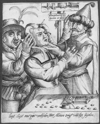 Trepanning, grabado por H. Weydmans (siglo XVI) de Dutch School