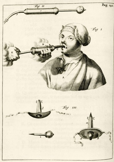 Usando una jeringa para administrar un purgante, de Exercitationes Practicae circa Medendi Methodum por Frederik Dekkers, 1694 de Dutch School