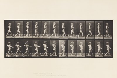 Placa 540. A, Piernas arqueadas; niño; B, Caries espinal; niña caminando de Eadweard Muybridge