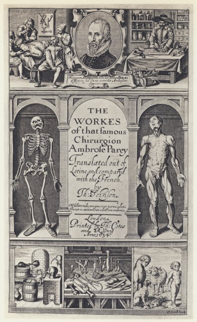 A Pare, Las obras, T Cotes y R Young 1634 de English Photographer