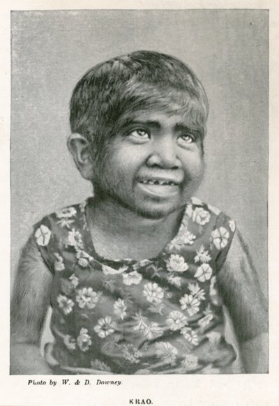 Krao, El Eslabón Perdido, exhibido en el Acuario, Westminster, Londres, en 1887 de English Photographer