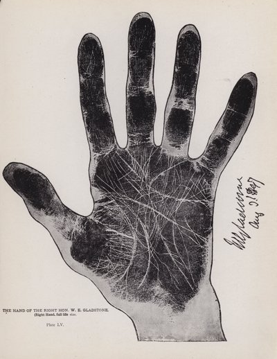 La mano del Excmo. Sr. W. E. Gladstone (fotografía en blanco y negro) de English Photographer