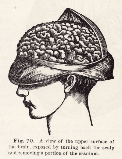 Vista de la superficie superior del cerebro, expuesta al retroceder el cuero cabelludo y remover una porción del cráneo (grabado) de English School
