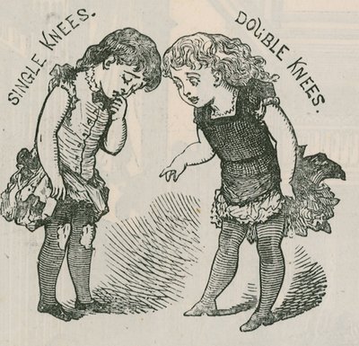 Anuncio de medias de doble rodilla para niños de English School