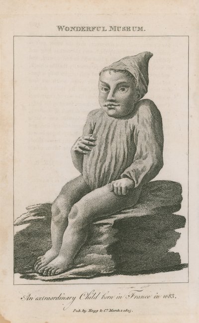 Un niño extraordinario nacido en Francia en 1683 de English School