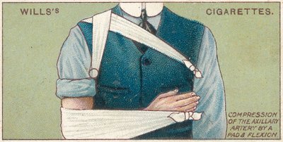 Compresión de la arteria axilar con una almohadilla y flexión, no.41 de la serie de primeros auxilios de las tarjetas de cigarrillos de Willss, 1913 de English School