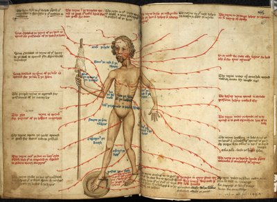 Harley 3719, ff.158v-159 Miniatura de un hombre sangrante con un pie en una bandeja sangrante y un eje en la mano, ilustración de 
