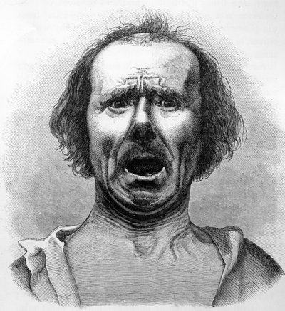 Horror y Agonía, copiado de una fotografía del Dr. Duchenne, ilustración de 