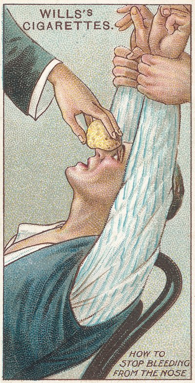 Cómo detener el sangrado de la nariz, no.31 de la serie de primeros auxilios de las tarjetas de cigarrillos de Willss, 1913 de English School