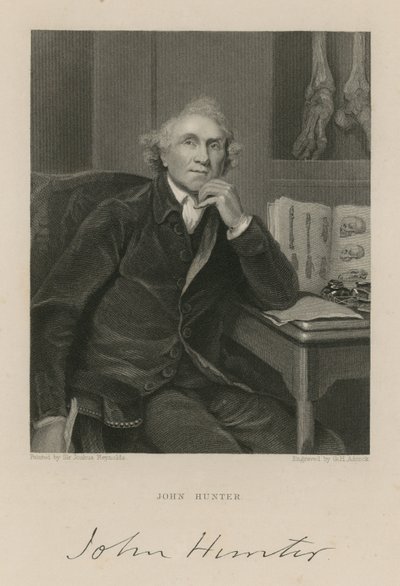 John Hunter de English School