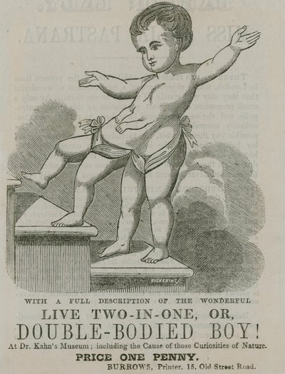 Vivo dos en uno, o niño de doble cuerpo de English School