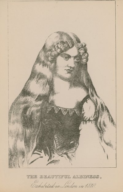 La hermosa albina, exhibida en Londres en 1810 de English School