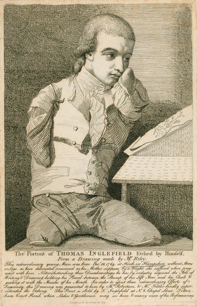 Thomas Inglefield, nacido el 18 de diciembre de 1769 en Hook, Hampshire, sin brazos ni piernas de English School
