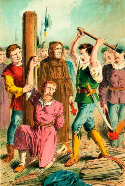 La mano de William Flower cortada de English School