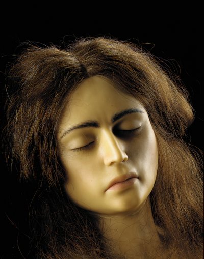 Modelo anatómico de un embarazo ovárico (detalle) de European School