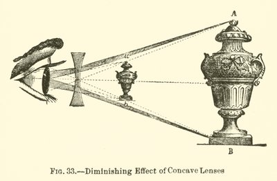 Efecto de Disminución de Lentes Cóncavas de European School