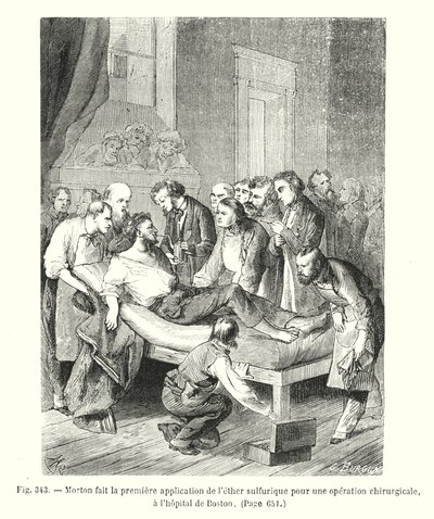 Morton hace la primera aplicación de éter sulfúrico para una operación quirúrgica, en el hospital de Boston de European School