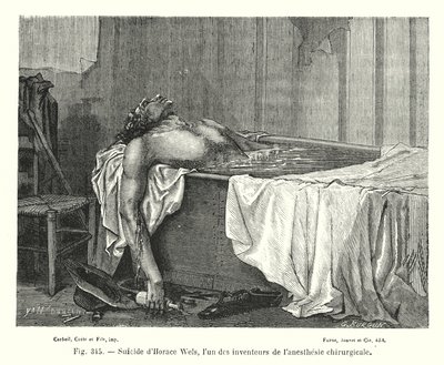 Suicidio de Horace Wels, uno de los inventores de la anestesia quirúrgica de European School