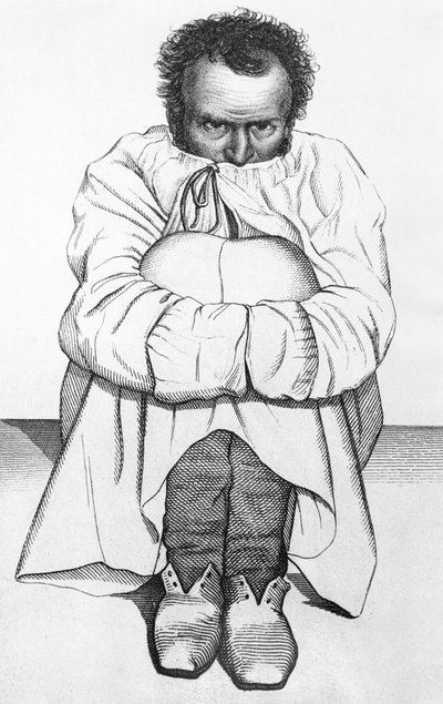 Un hombre loco, ilustración de un libro por Jean Etienne Dominique Esquirol (1772-1840) de French School