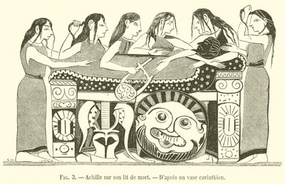 Aquiles en su lecho de muerte de French School