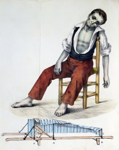 Cholera Morbus, de Relacao, Historica, Statistica e Medica da Cholera-Morbus por Francisco dAssis de Souza Vaz, 1833 de French School