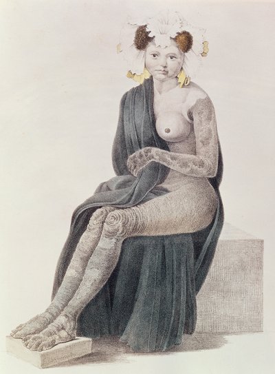 Ictiosis congénita, de un libro de G.M. Olbers, 1830 de French School