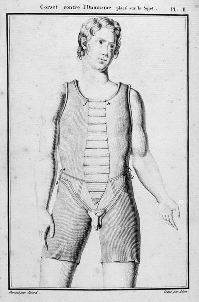 Corsé para prevenir el onanismo, ilustración de Traité des bandages et appareils por J.B.J. Thillaye, París, publicado en 1815 de French School