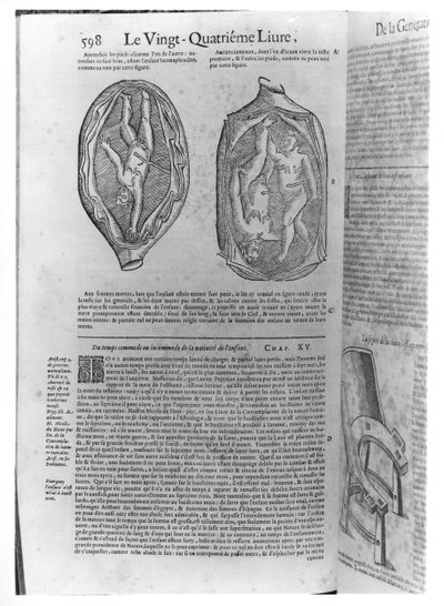 Feto, ilustración de Oeuvres de Ambroise Paré (1509-90) publicado en Lyon, 1641 de French School