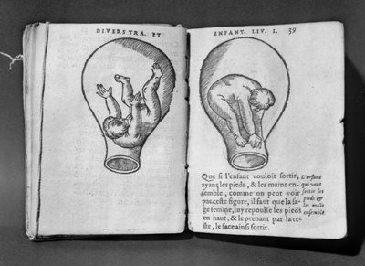 Feto en el útero, ilustración del llamado manuscrito Rhodion de French School