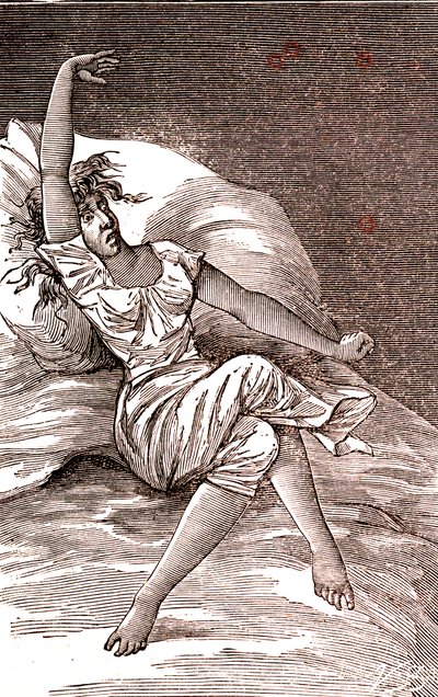 Dolores de cabeza, melancolía e histeria, ansiedad. 1887 (grabado) de French School