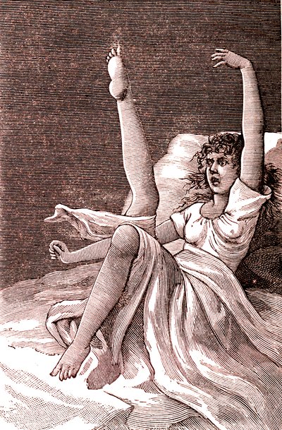 Histeria, fenómeno extremadamente mental, psicosis y psiconeurosis.1887 (grabado) de French School