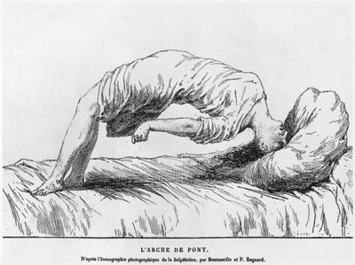 Histeria y sonambulismo, de Les Maladies Epidemiques de l