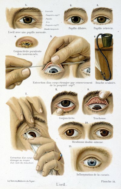 Medicina: el ojo de French School