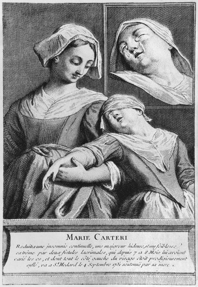 Curación milagrosa de una mujer ciega, Marie Carteri, en la tumba del diácono François de Paris en el cementerio parroquial Saint-Médard en París de French School