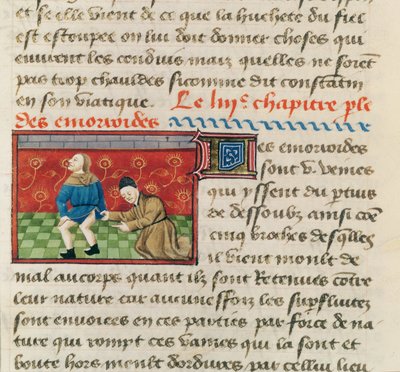 Ms 22532 Examen de un paciente con hemorroides, de Le Livre des Proprietes des choses por Barthelemy l