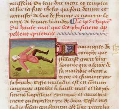 Ms 22532 Paciente sufriendo un ataque epiléptico, de Le Livre des Proprietes des choses por Barthelemy l