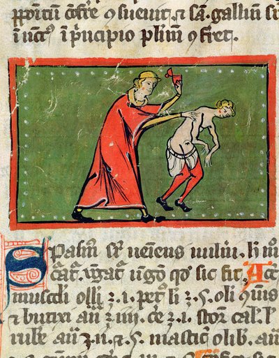 Doctor tratando la espalda de un paciente, de una edición del Libro de Cirugía de Rogier de Salerne de French School